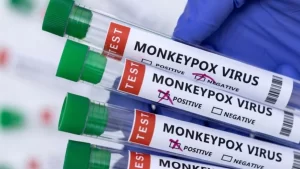 Virologist: Here's why it's tough to control spread of monkeypox