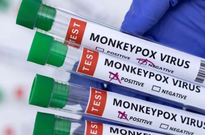 Virologist: Here's why it's tough to control spread of monkeypox